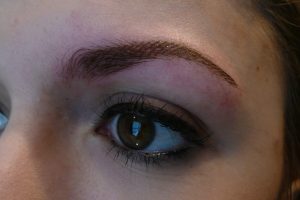 eyebrow-enhancement-after